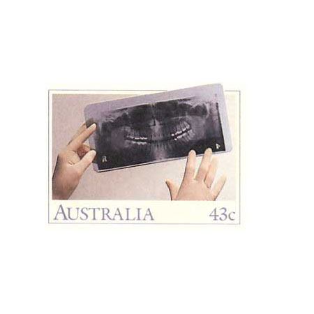 Timbres